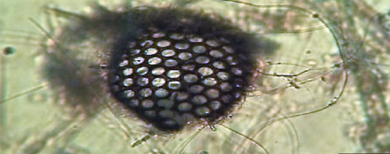 Diatomea Stephanopixis sp ?